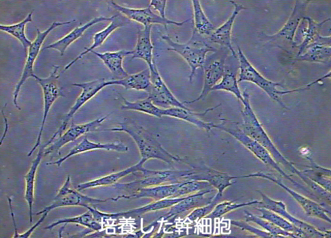 培養した幹細胞
